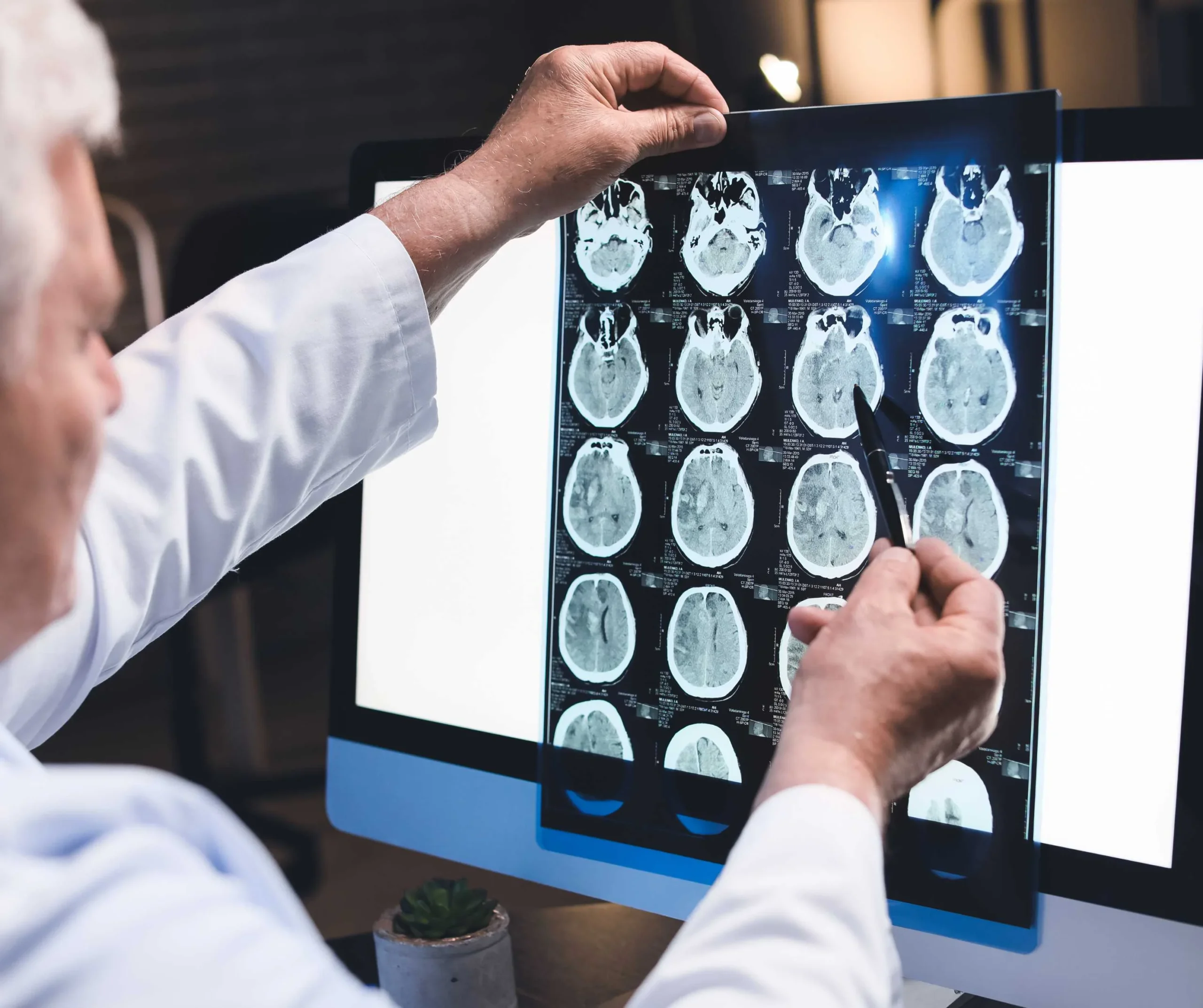 CT Scan
