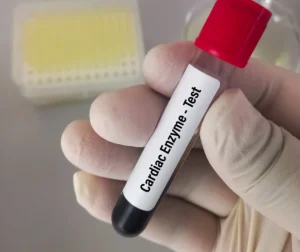 Cardiac Enzyme Service