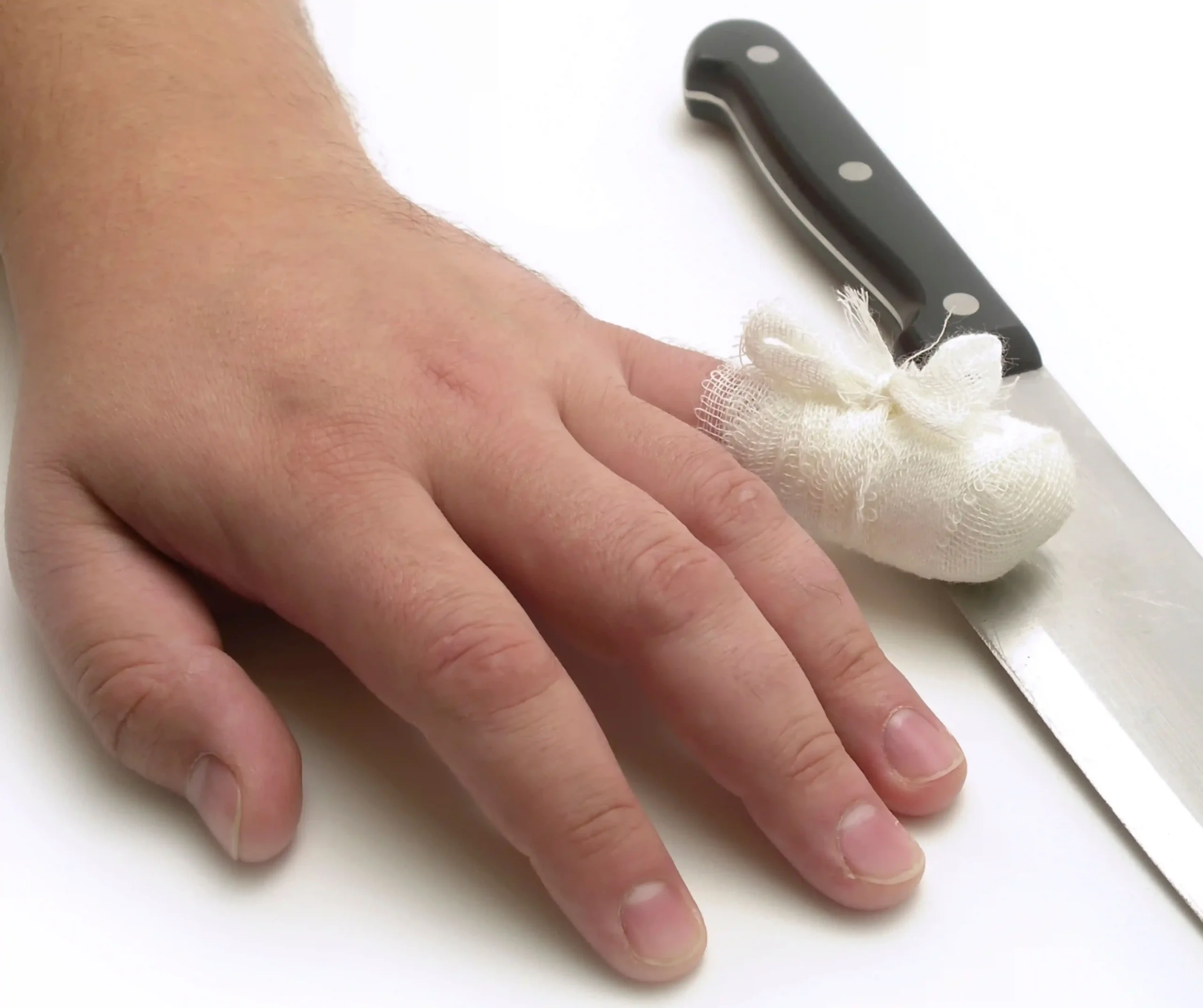 Children Lacerations and injuries