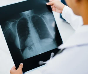 Digital X Ray Services