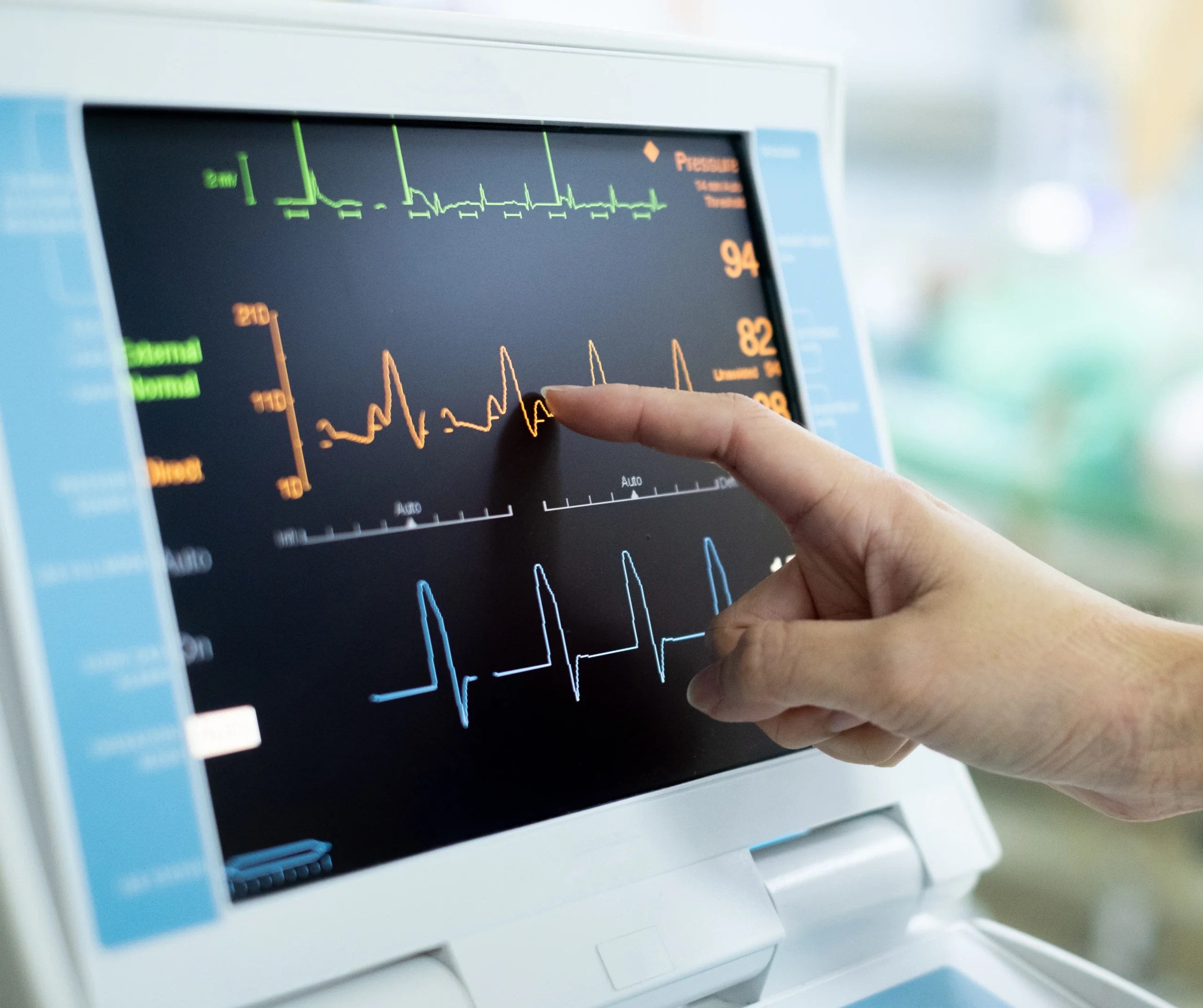 EKG Service