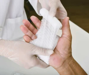 Laceration Treatment