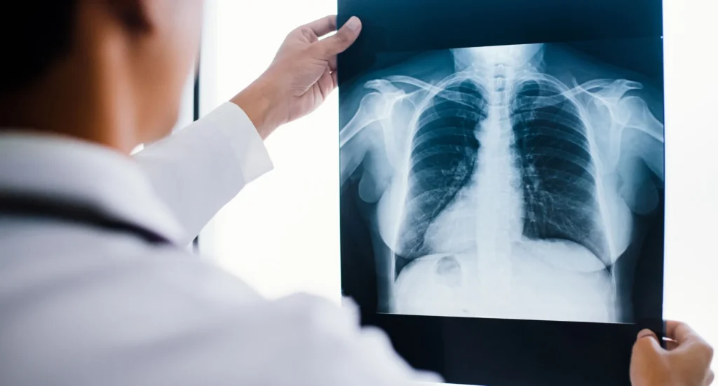 What Is Digital X-Ray
