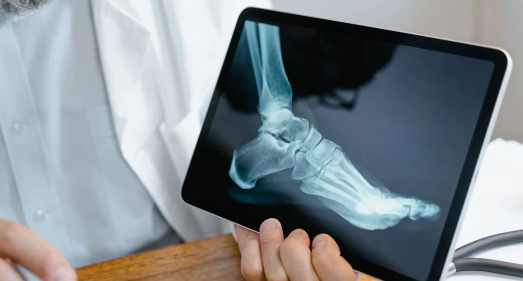 Benefits of Digital X-Ray Over Traditional Imaging