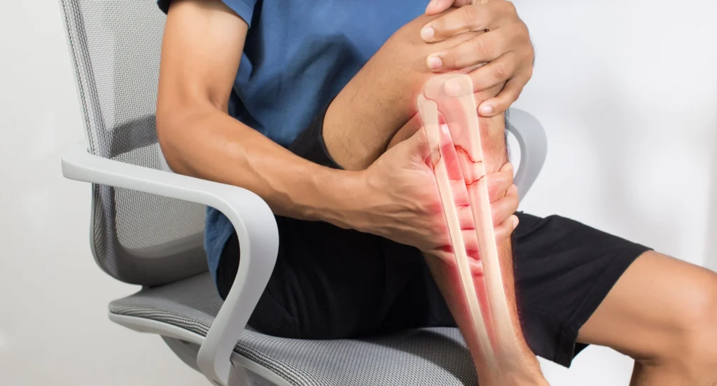 Broken Bone FAQs