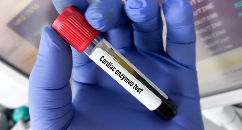 What Is a Cardiac Enzyme Test