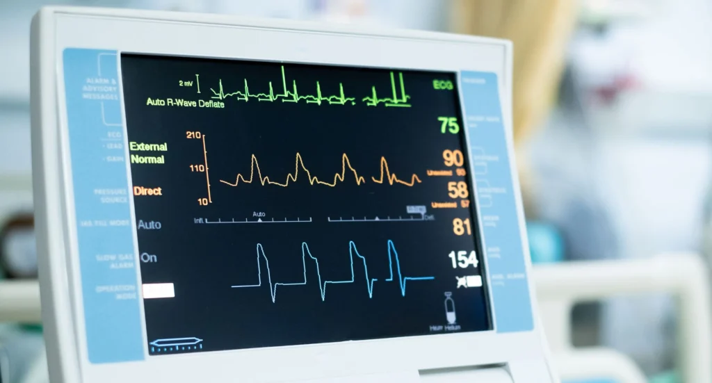 What Is an Electrocardiogram (EKG)