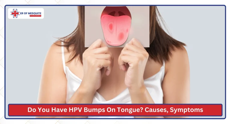 Do You Have HPV Bumps On Tongue Causes, Symptoms, and Treatment