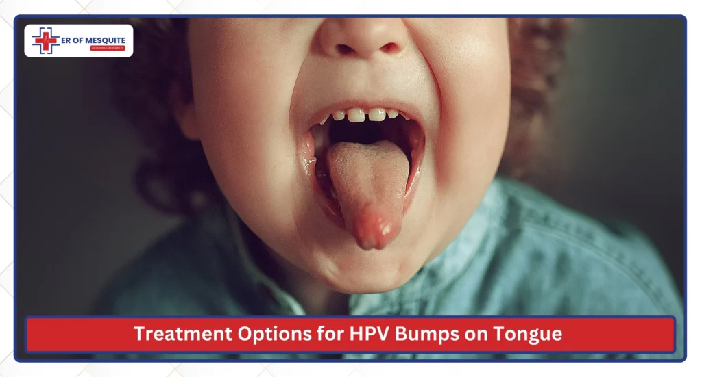 Treatment Options for HPV Bumps on Tongue