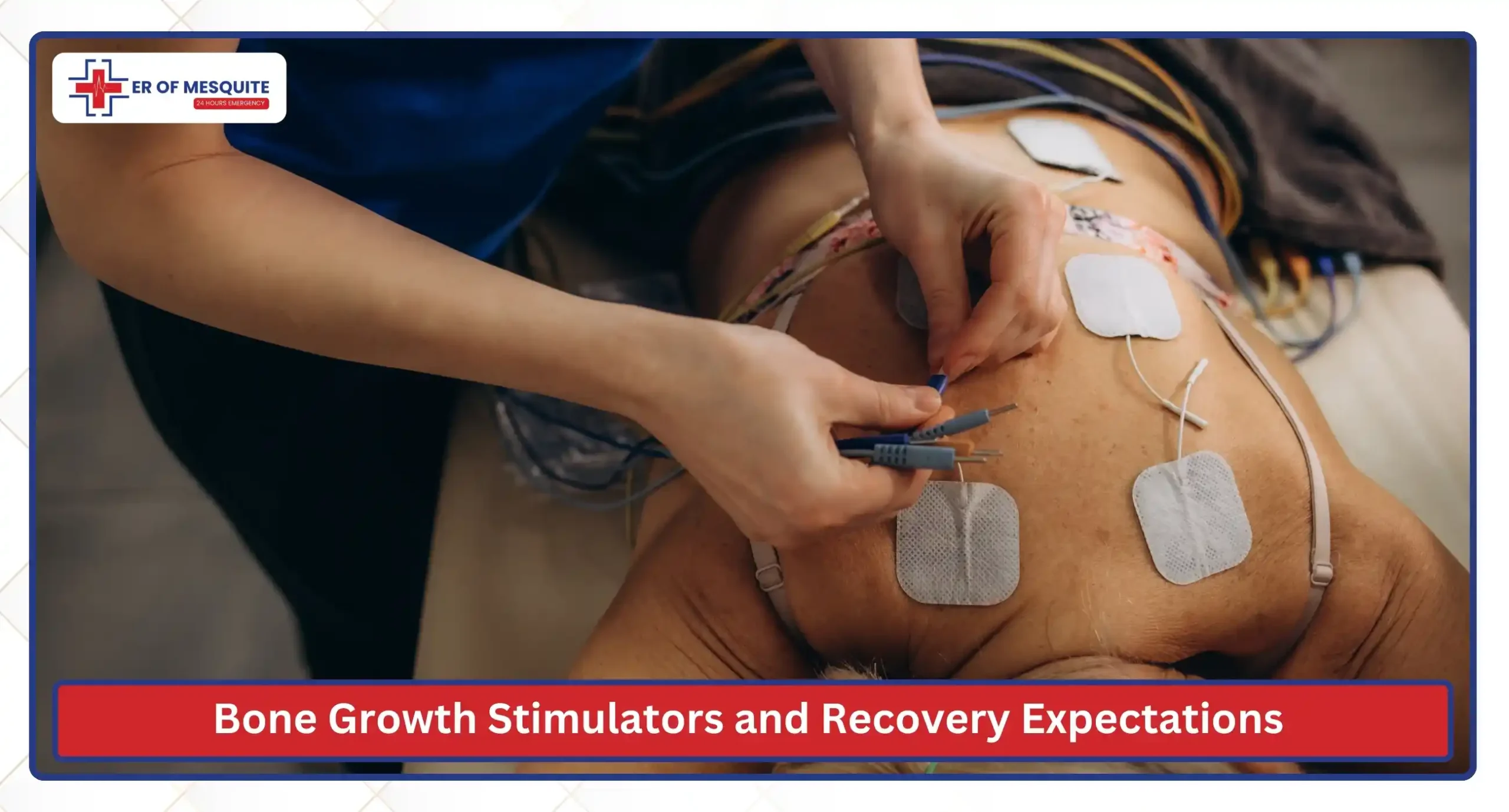 Bone Growth Stimulators and Recovery Expectations