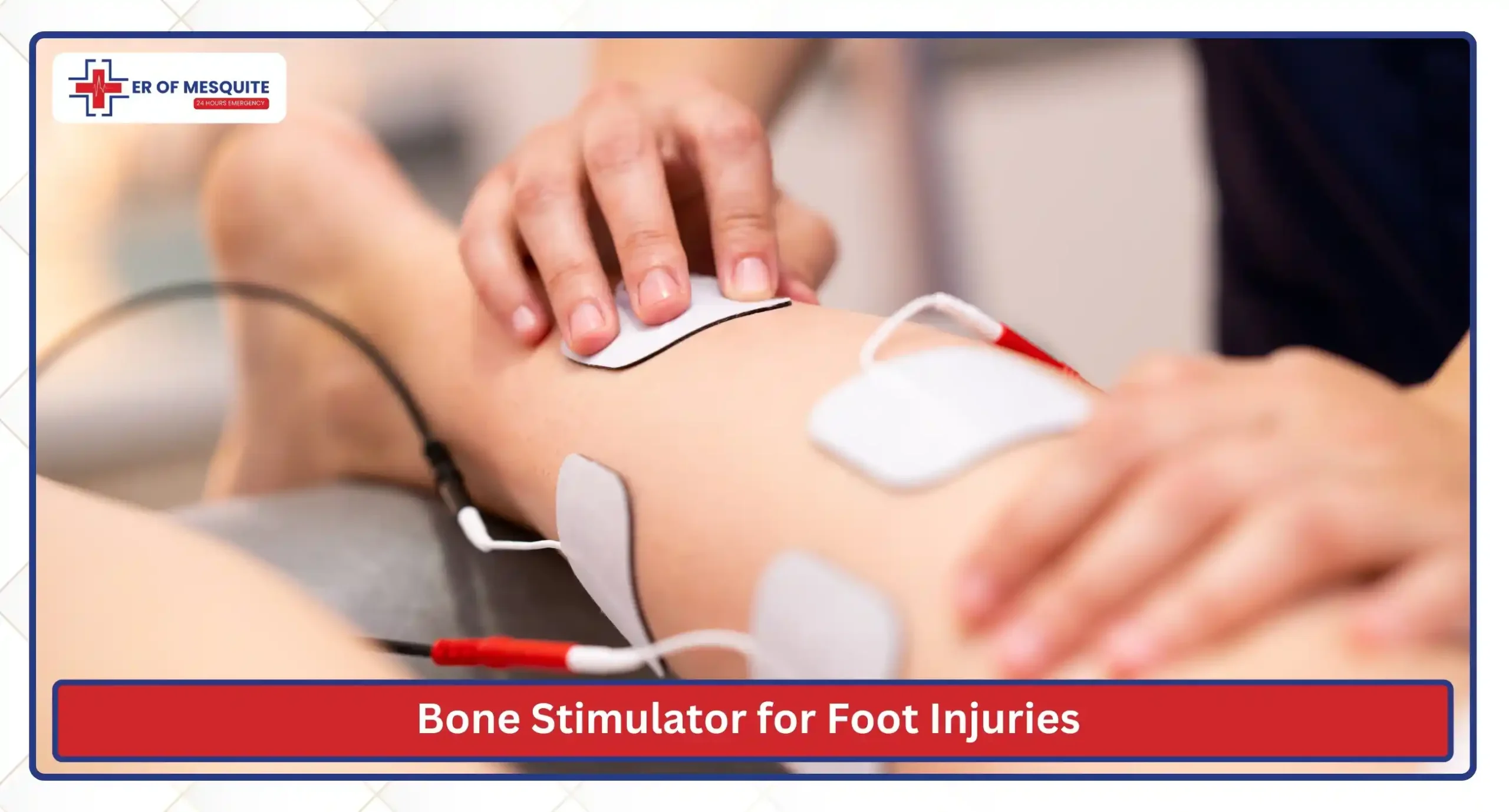 Bone Stimulator for Foot Injuries