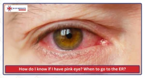 How do I know if I have pink eye When to go to the ER
