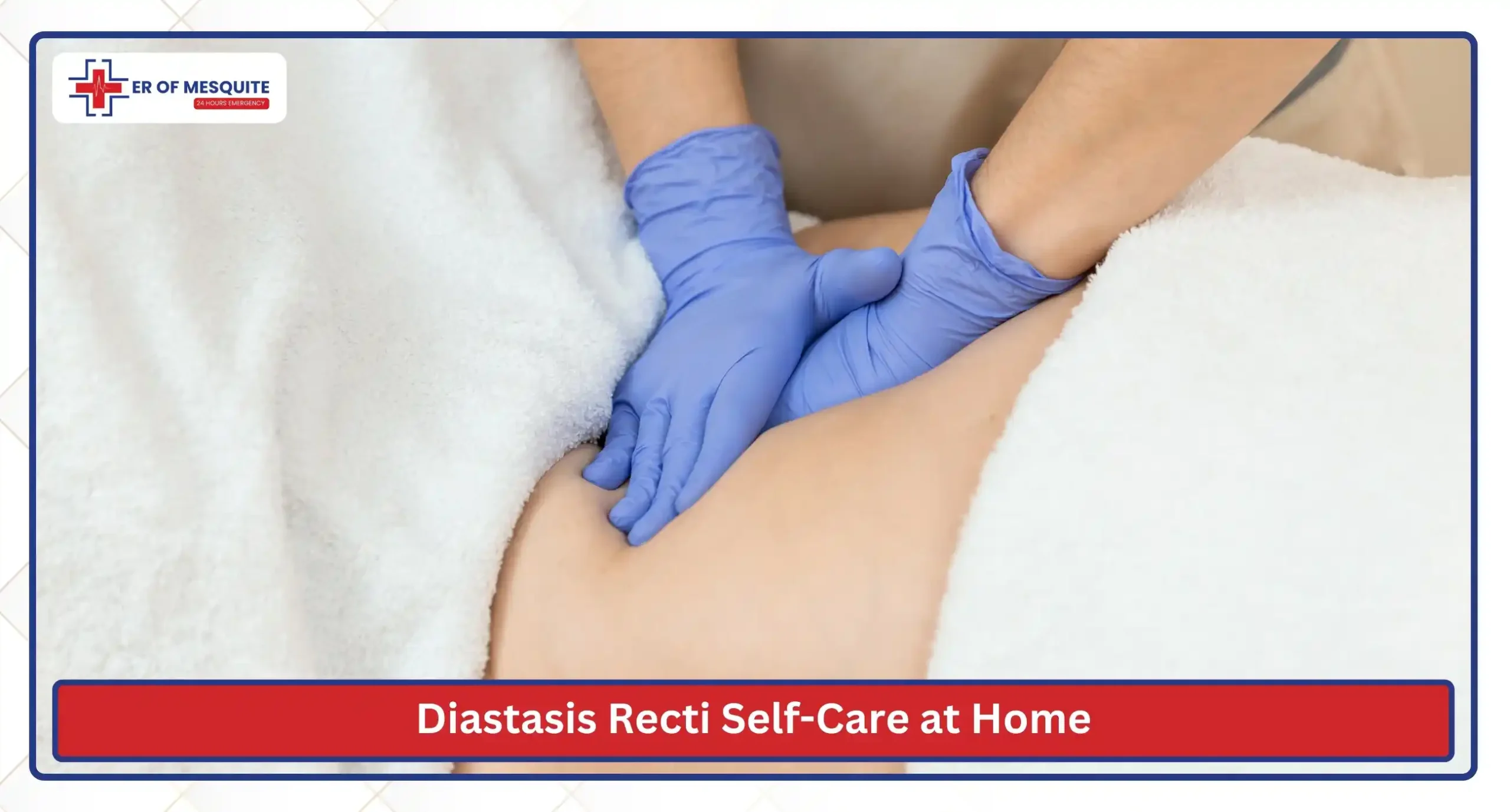 Diastasis Recti Self-Care at Home