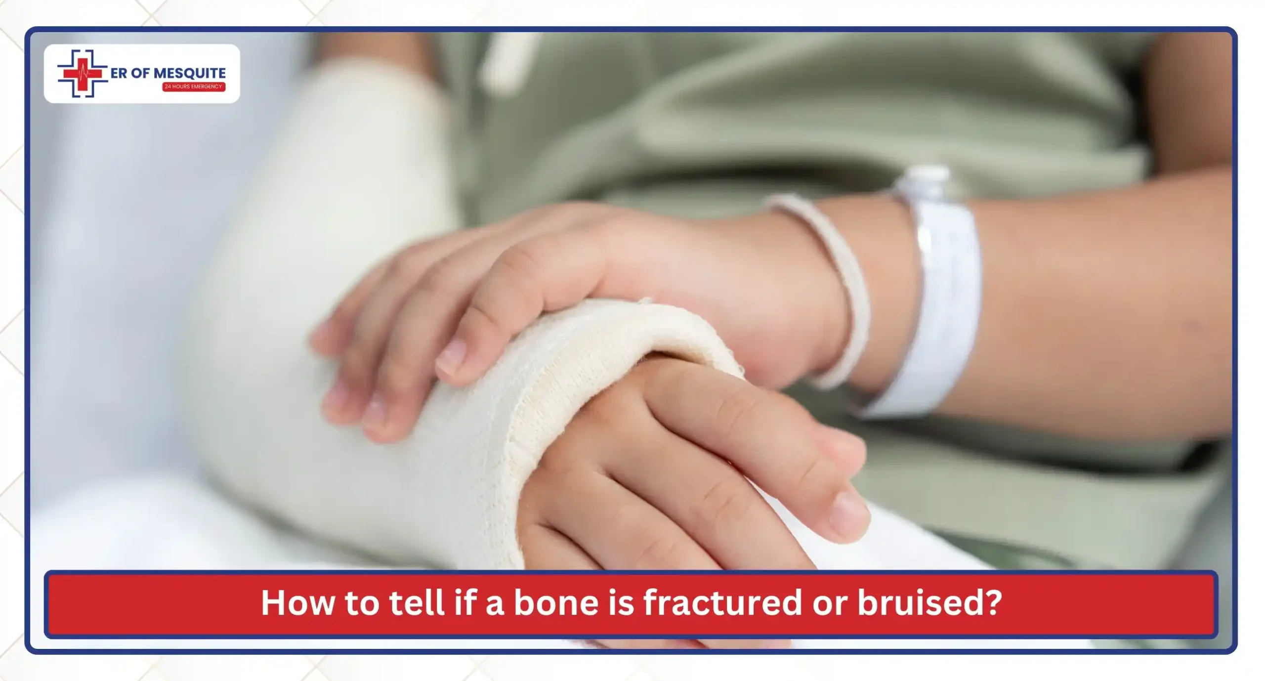 How to tell if a bone is fractured or bruised