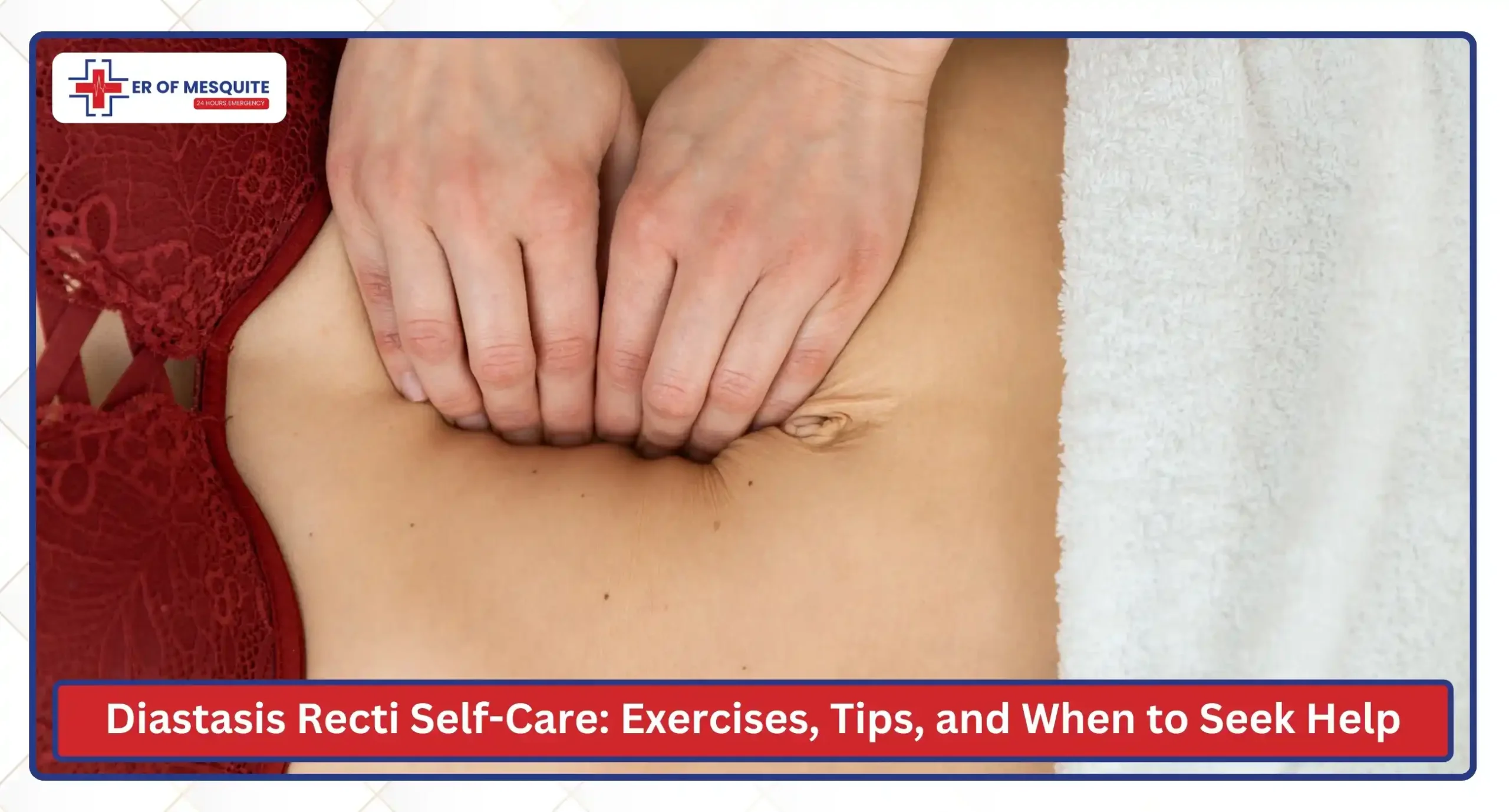 What Is Diastasis Recti