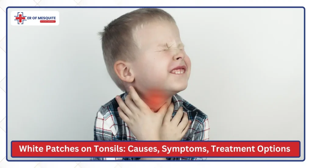 White Patches on Tonsils Causes, Symptoms, Treatment Options