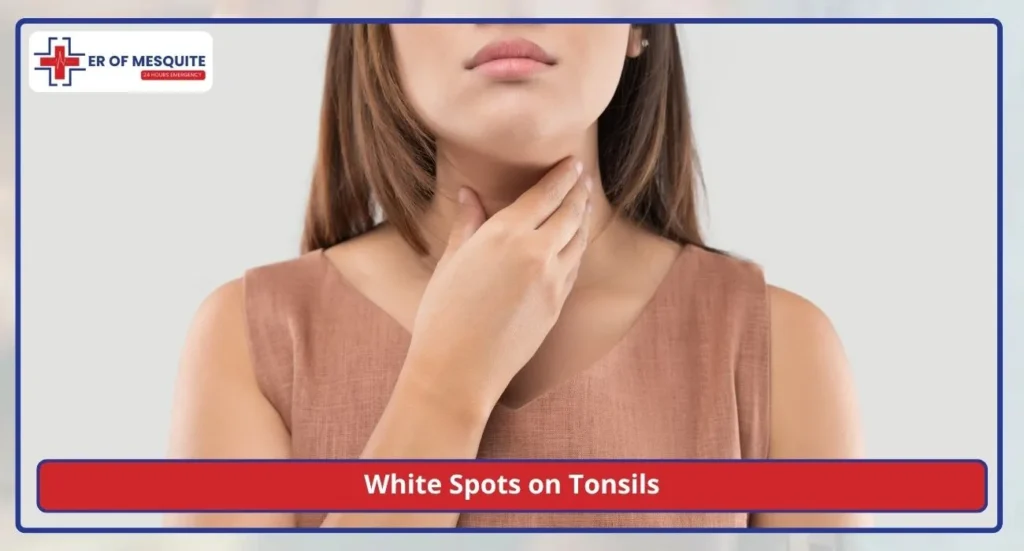 White Spots on Tonsils What Causes Them, With or Without a Fever