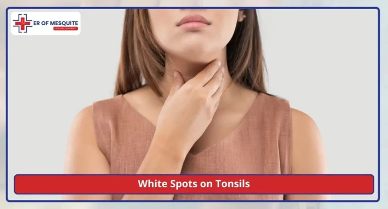 White Spots on Tonsils What Causes Them, With or Without a Fever