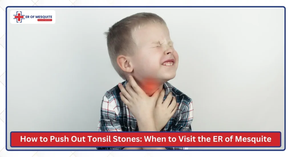 How to Push Out Tonsil Stones: Safe Methods, Symptoms & When to Visit the ER of Mesquite