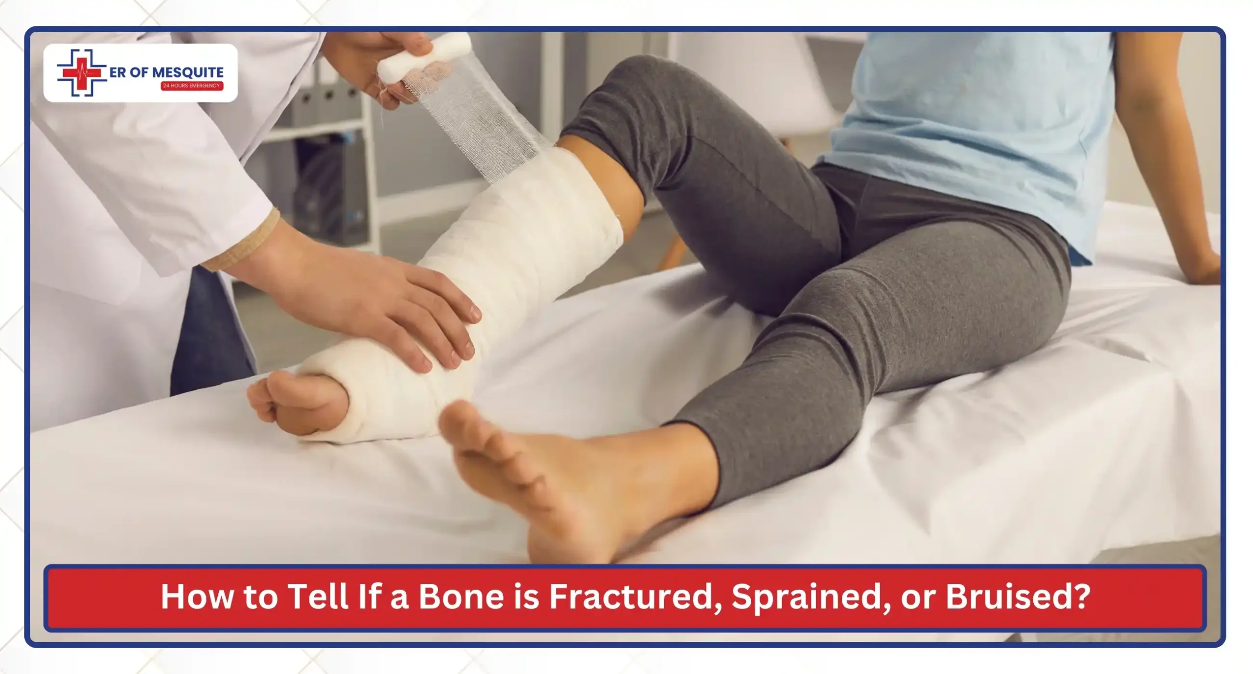 How to Tell If a Bone is Fractured, Sprained, or Bruised