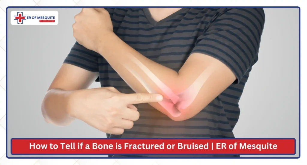 How to Tell if a Bone is Fractured or Bruised ER of Mesquite