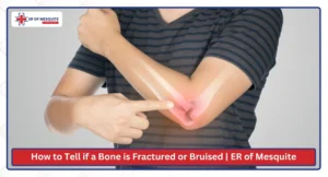 How to Tell if a Bone is Fractured or Bruised ER of Mesquite