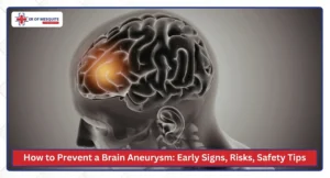 How to Prevent a Brain Aneurysm Early Signs, Risks, and Safety Tips