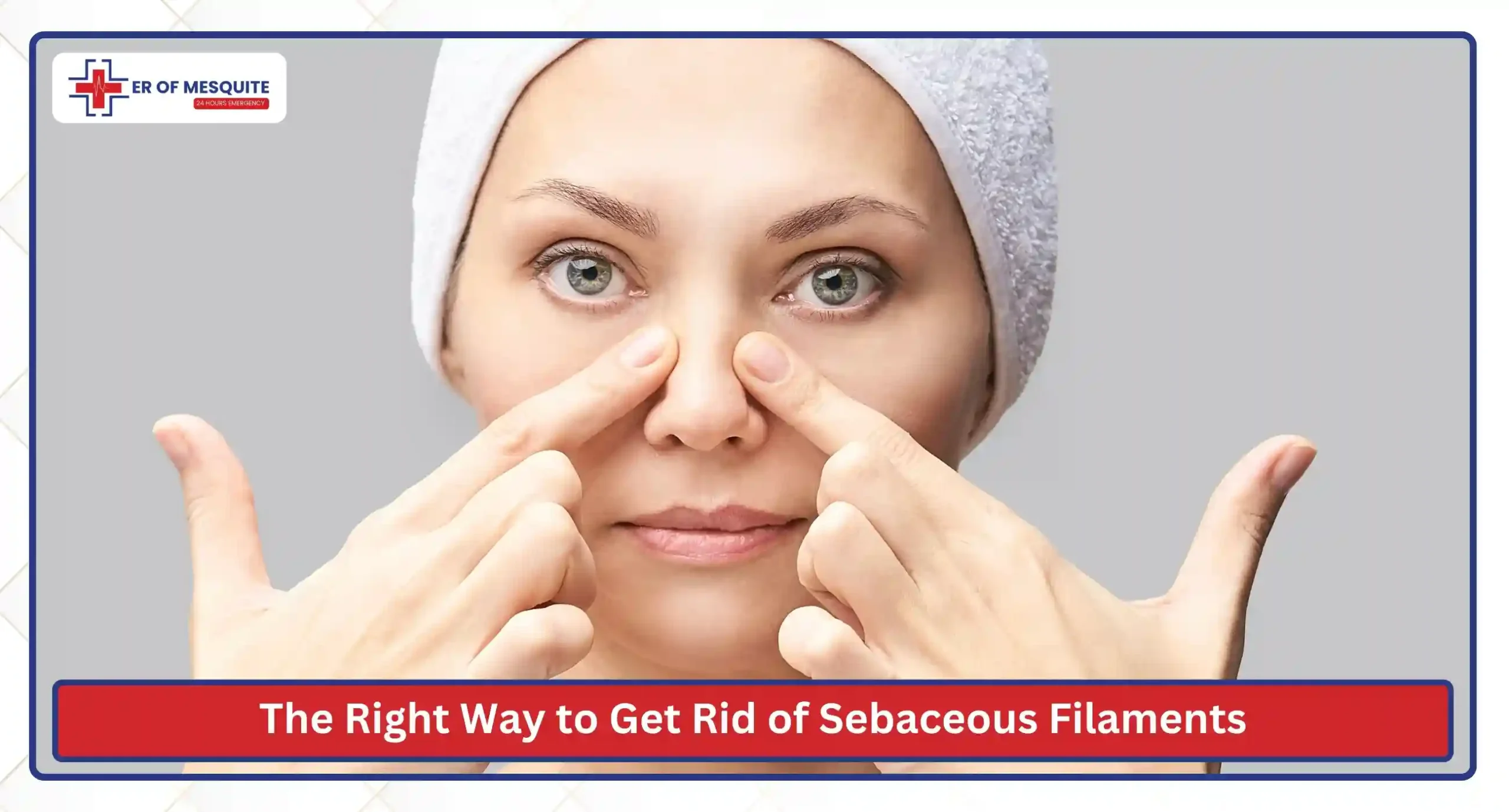 The Right Way to Get Rid of Sebaceous Filaments