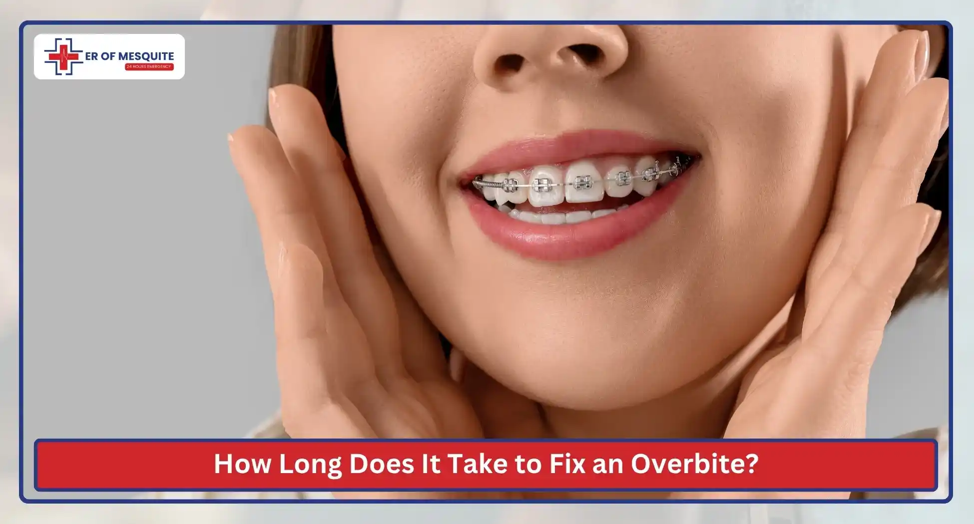 How Long Does It Take to Fix an Overbite