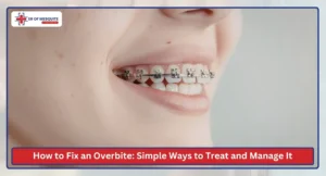 How to Fix an Overbite Simple Ways to Treat and Manage It