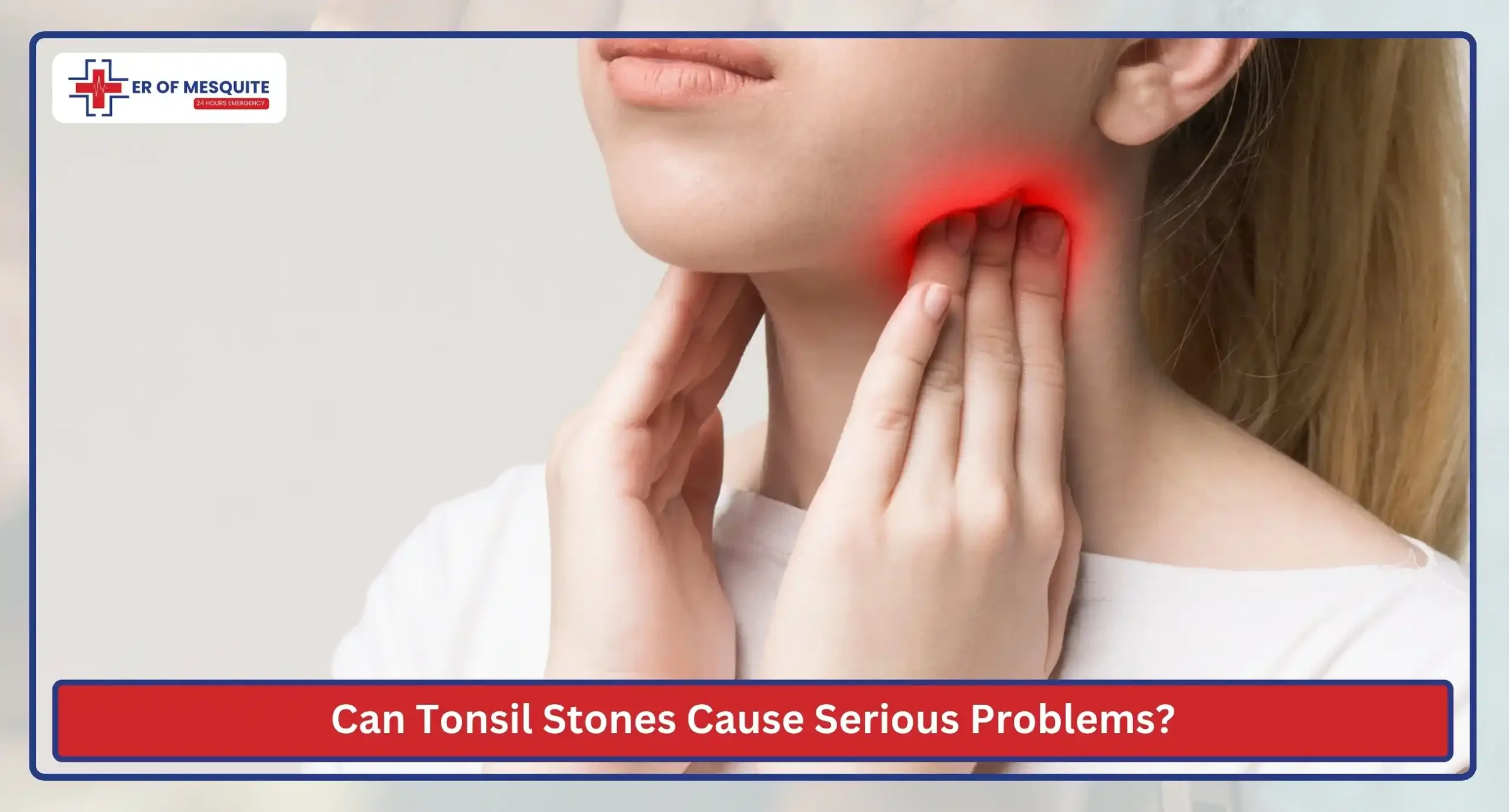Can Tonsil Stones Cause Serious Problems