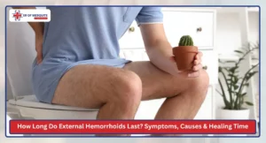How Long Do External Hemorrhoids Last Symptoms, Causes & Healing Time