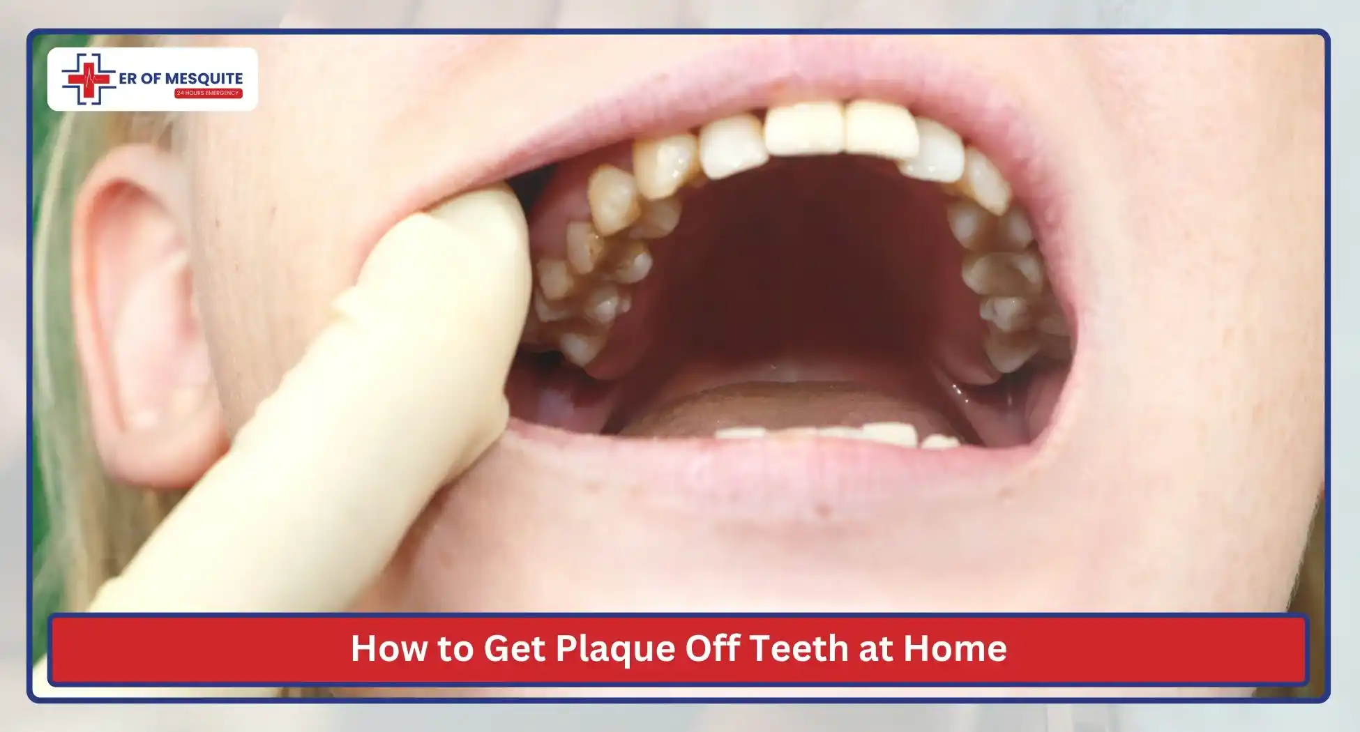 How to Get Plaque Off Teeth at Home