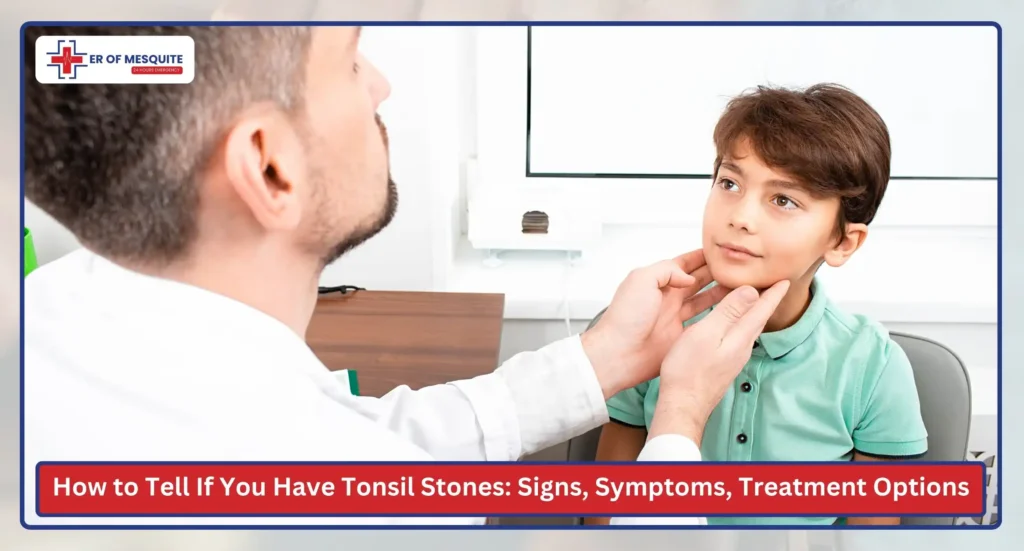 How to Tell If You Have Tonsil Stones