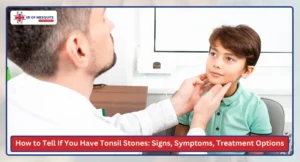 How to Tell If You Have Tonsil Stones