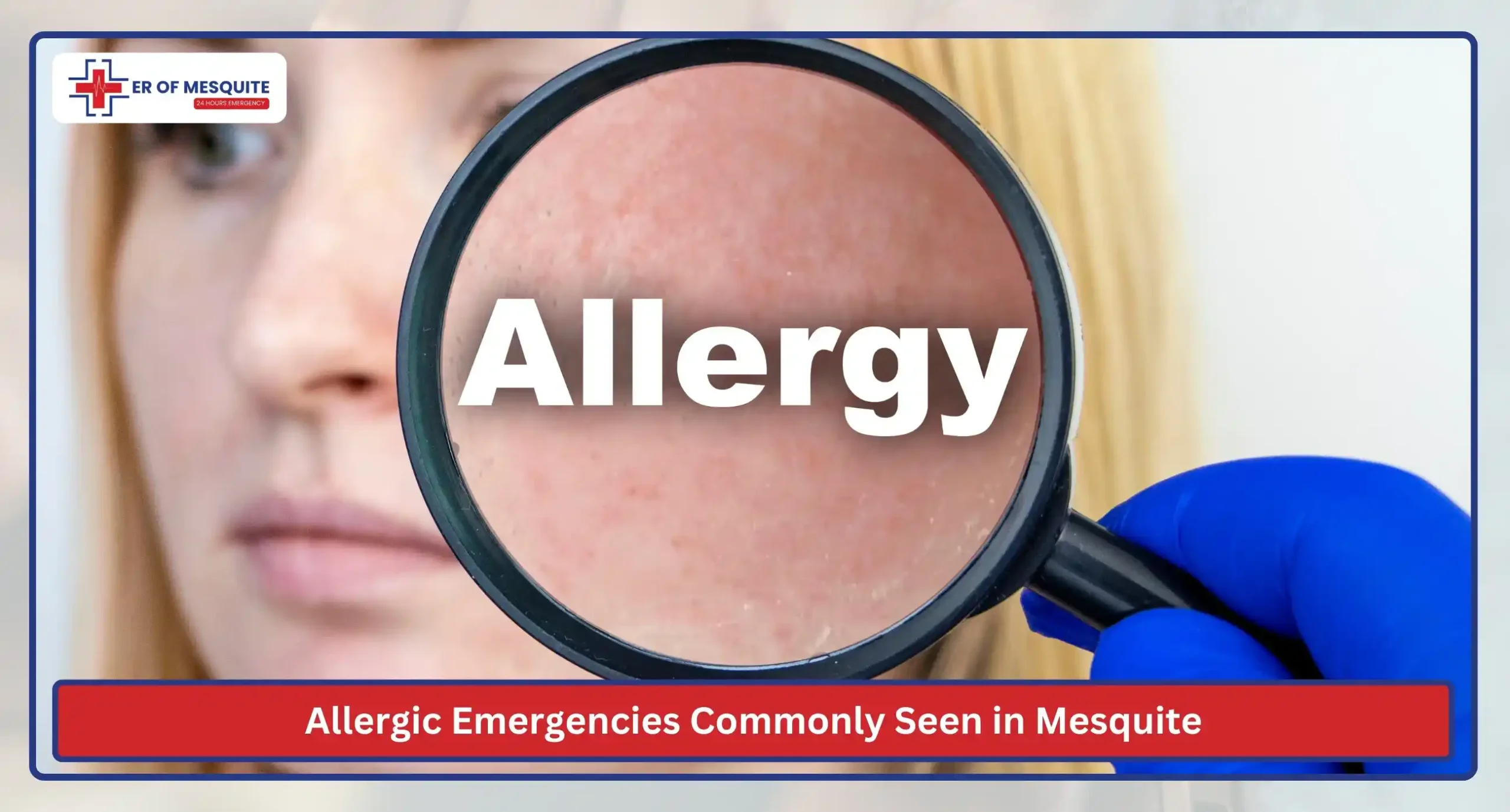 Allergic Emergencies Commonly Seen in Mesquite