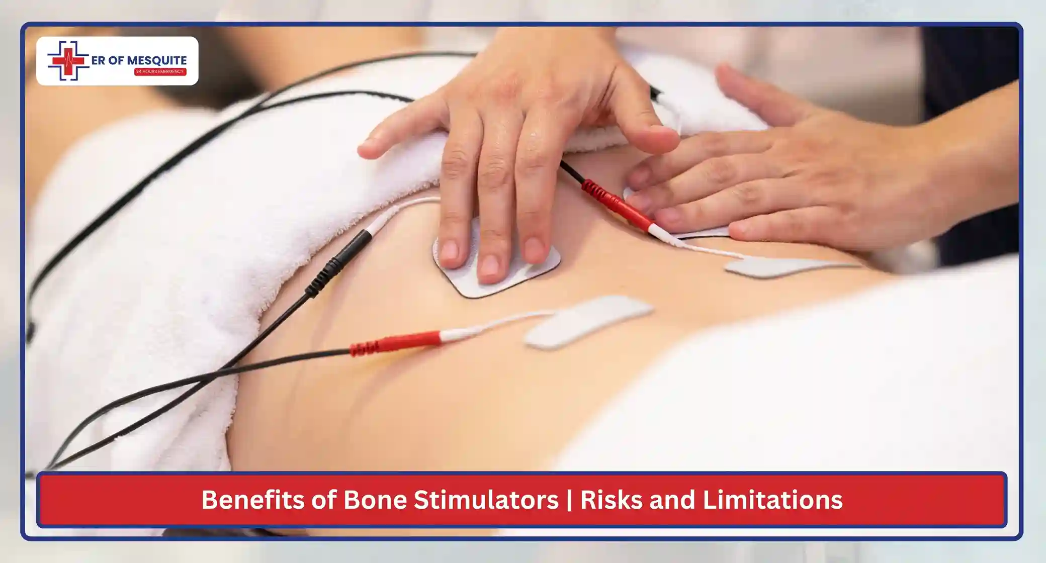 Benefits of Bone Stimulators