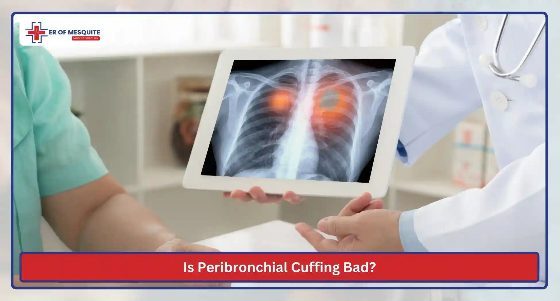Is Peribronchial Cuffing Bad