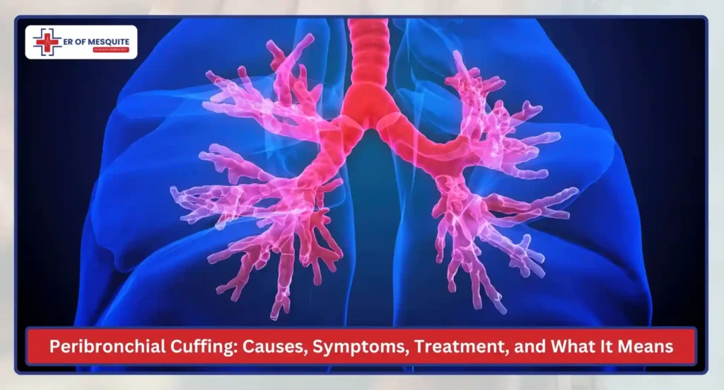 Peribronchial Cuffing Causes, Symptoms, Treatment, and What It Means