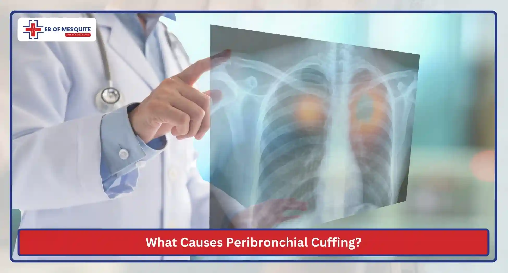 What Causes Peribronchial Cuffing